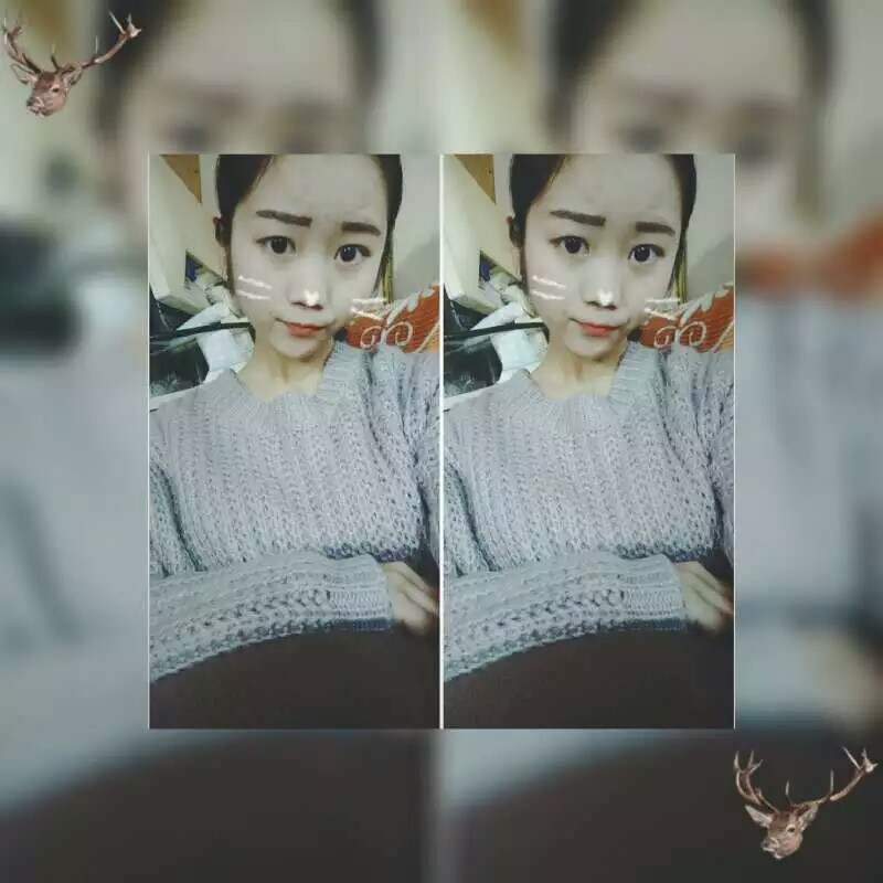 43326395