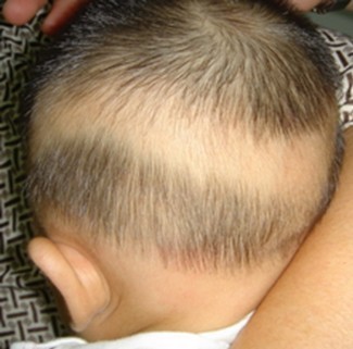 1岁宝宝头发稀少照片图片