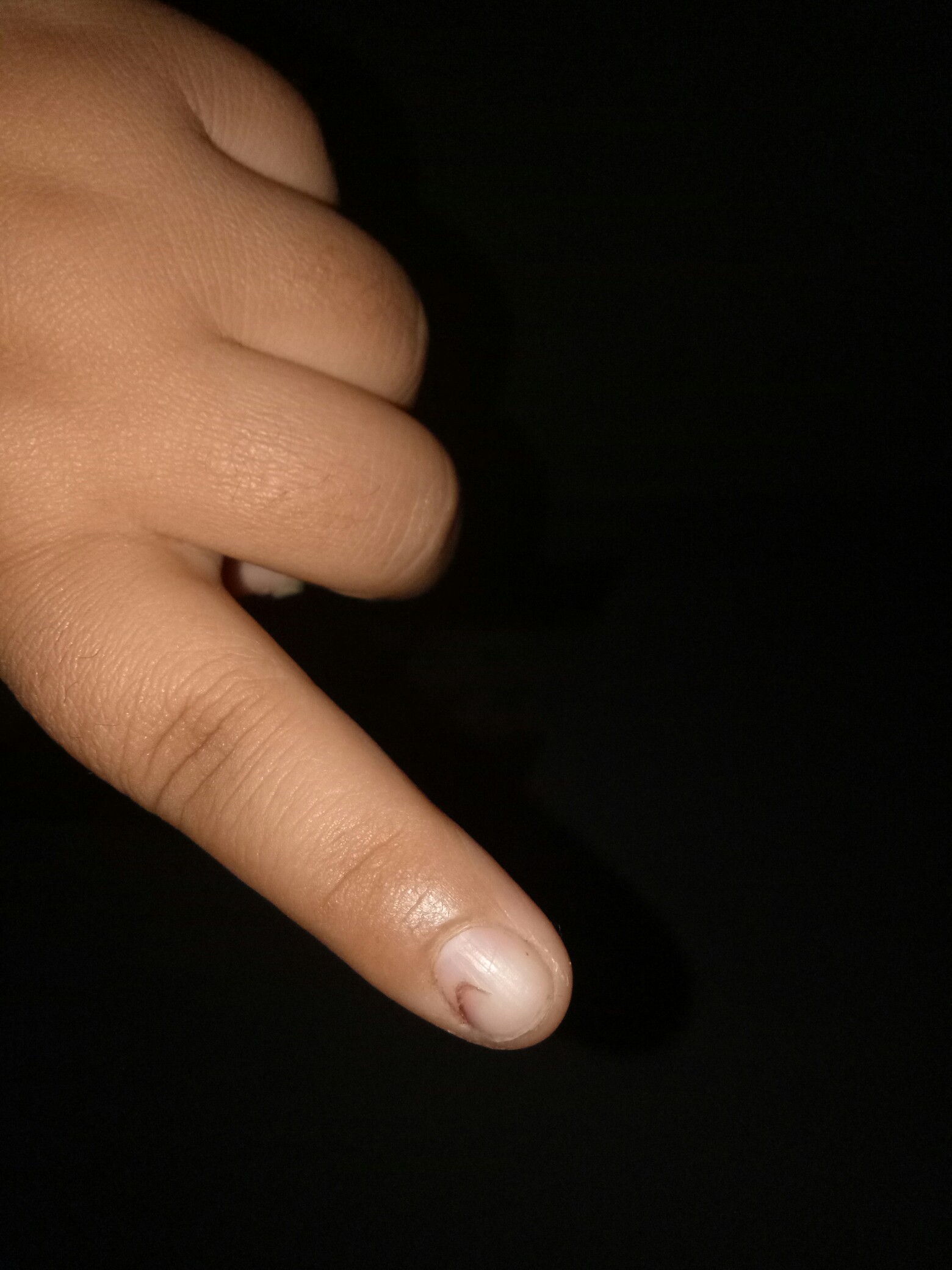 我的手又挨刀子了